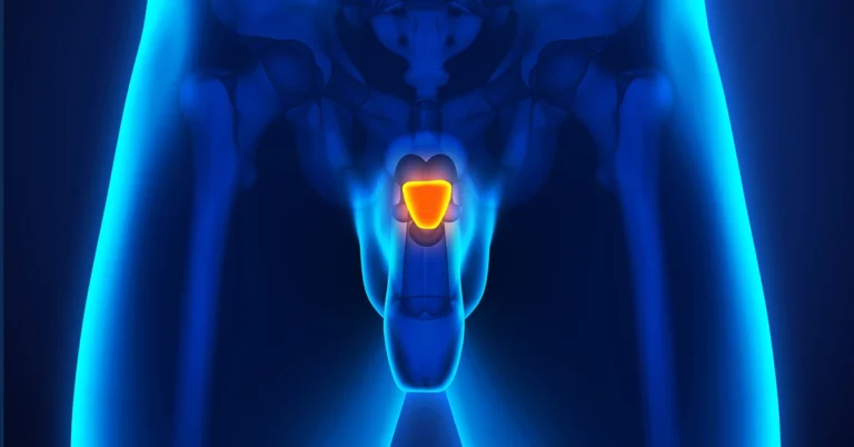 Does RAD-140 Enlarge the Prostate? What the Research Examines